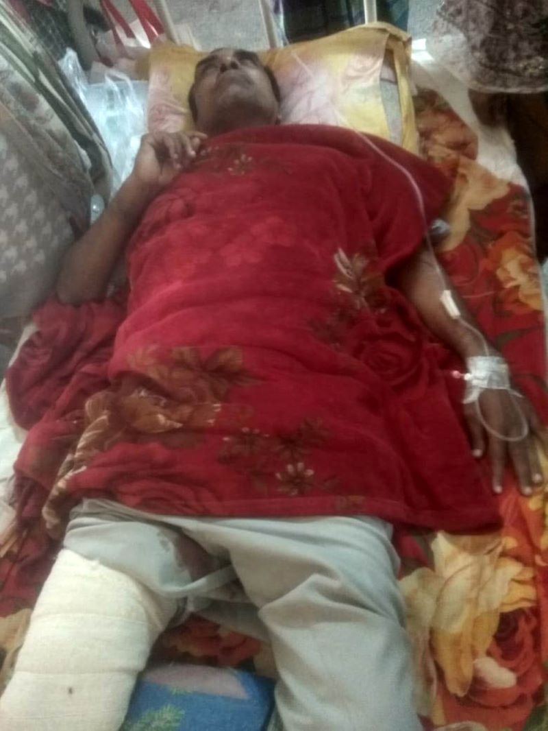 পিটিয়ে ইউনিয়ন পরিষদের চেয়ারম্যানের পা ভেঙ্গে দিল প্রতিপক্ষ